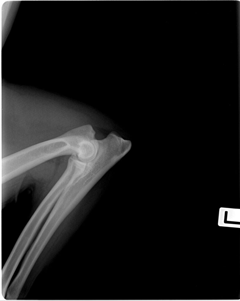 Roentgebilder Gutachten mit 12 Monaten (1)